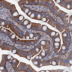 Anti-MS4A4E Antibody