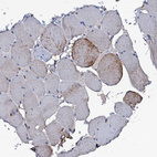 Anti-MS4A4E Antibody