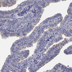 Anti-CFAP61 Antibody