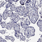 Anti-CFAP61 Antibody