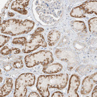 Anti-COLGALT2 Antibody