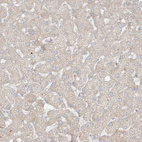 Anti-COLGALT2 Antibody