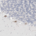 Anti-TSEN2 Antibody