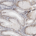 Anti-TSEN2 Antibody