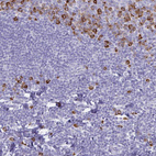 Anti-FNTB Antibody