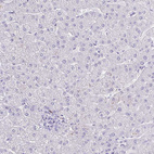 Anti-FNTB Antibody