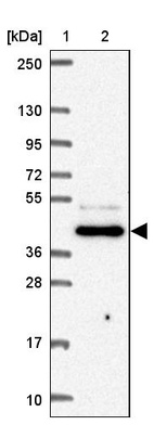 Anti-FNTB Antibody