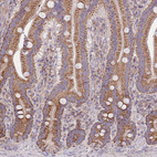 Anti-SLC25A42 Antibody