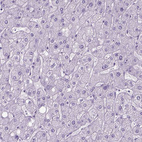 Anti-GABRB2 Antibody