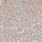 Anti-GSDMB Antibody