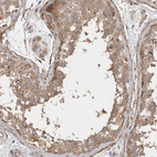 Anti-GSDMB Antibody