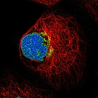 Anti-FUT11 Antibody