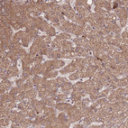 Anti-ATP13A2 Antibody