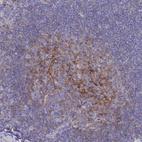 Anti-F11R Antibody