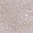 Anti-F11R Antibody