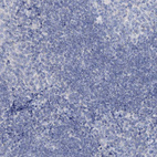 Anti-DTD1 Antibody