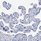 Anti-DTD1 Antibody