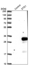 Anti-DTD1 Antibody