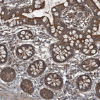 Anti-NDUFA2 Antibody