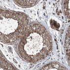 Anti-NDUFA2 Antibody