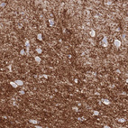 Immunohistochemical staining of human cerebral cortex shows strong cytoplasmic positivity in neuropil.