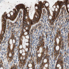 Immunohistochemical staining of human rectum shows strong membranous and cytoplasmic positivity in glandular cells.