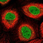 Immunofluorescent staining of human cell line A-431 shows localization to nucleoplasm & nuclear membrane.