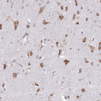 Anti-RPS3 Antibody