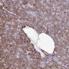 Anti-RPS3 Antibody