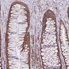 Anti-RPS3 Antibody