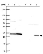 Anti-RPS3 Antibody