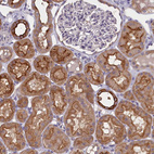 Anti-COL19A1 Antibody