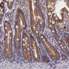 Anti-COL19A1 Antibody