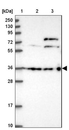 Anti-DCAF4 Antibody