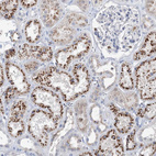 Anti-SIAE Antibody