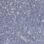 Anti-SIAE Antibody