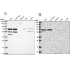 Anti-SIAE Antibody