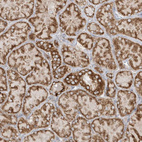 Anti-SH3BP2 Antibody