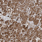 Anti-SH3BP2 Antibody