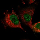 Anti-SH3BP2 Antibody