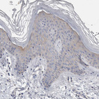 Anti-OTOR Antibody