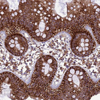 Immunohistochemical staining of human colon shows strong cytoplasmic granular/cytoplasmic membranous positivity in glandular cells.