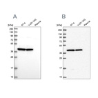 Western blot analysis using Anti-MRPS9 antibody HPA043476 (A) shows similar pattern to independent antibody HPA048479 (B).