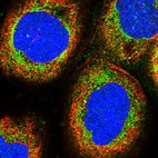 Immunofluorescent staining of human cell line A-431 shows localization to mitochondria.