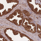 Anti-PODXL2 Antibody