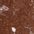 Anti-PODXL2 Antibody