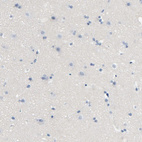 Immunohistochemical staining of human cerebral cortex shows no positivity in neurons as expected.