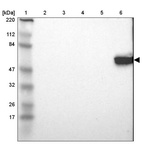 Lane 1: Marker [kDa] 220, 112, 84, 47, 32, 26, 17_br/_Lane 2: Human cell line RT-4_br/_Lane 3: Human cell line U-251MG sp_br/_Lane 4: Human plasma (IgG/HSA depleted)_br/_Lane 5: Human liver tissue_br/_Lane 6: Human tonsil tissue