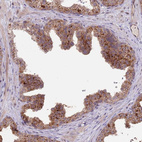 Anti-PRR16 Antibody