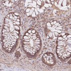 Anti-PRR16 Antibody